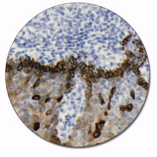 Cytokeratin 19 (Concentrate)