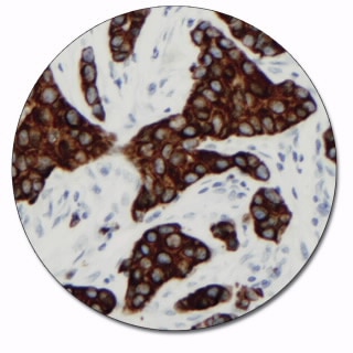 Cytokeratin 19 (Concentrate)