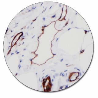 CD31, Endothelial Cell (Autostainer Link 48)