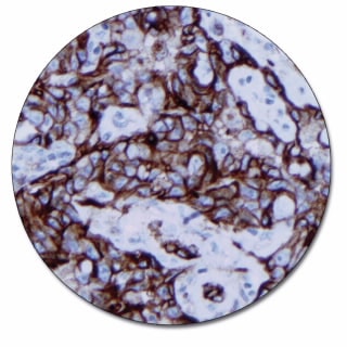 CD31, Endothelial Cell (Concentrate)