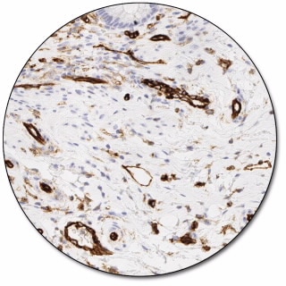 CD31, Endothelial Cell (Dako Omnis)