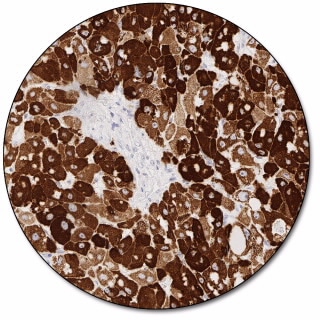 Hepatocyte (Dako Omnis)