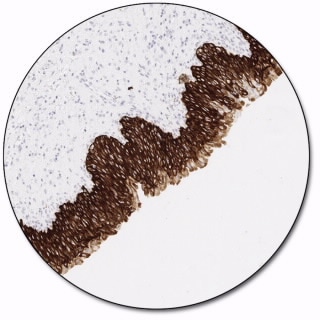 Cytokeratin, High Molecular Weight (Dako Omnis)
