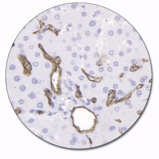 CD34 Class II (Autostainer Link 48)