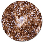 Lambda Light Chains (Concentrate)