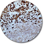 Lambda Light Chains (Concentrate)