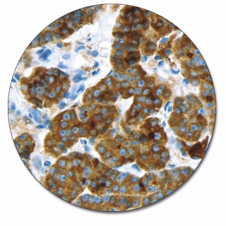 サイログロブリン (濃縮抗体)