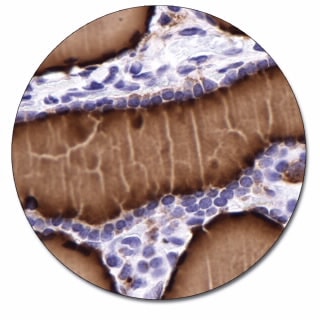 サイログロブリン (濃縮抗体)