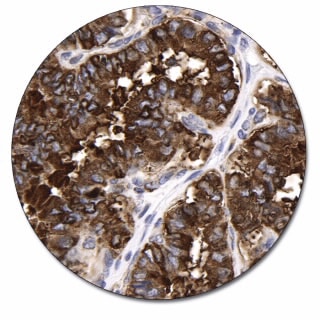 サイログロブリン (濃縮抗体)