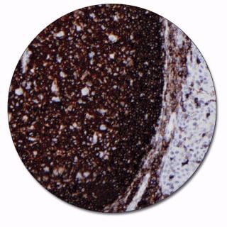 CD45, Leucocyte Common Antigen (Autostainer Link 48)