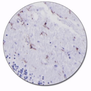 CD45, Leucocyte Common Antigen (Autostainer Link 48)