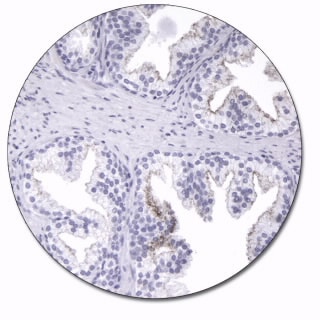 AMACR (Autostainer Link 48)