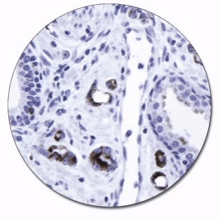 AMACR (Autostainer Link 48)