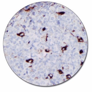 CD68 (Autostainer Link 48)