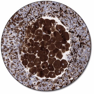 Melanosome (Concentrate)