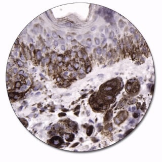 Melanosome (Concentrate)