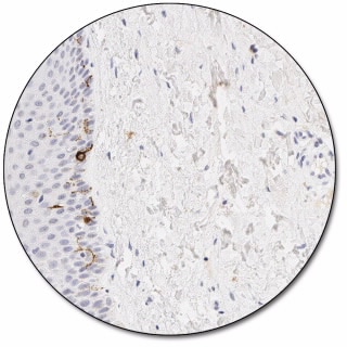 Melanosome (Concentrate)