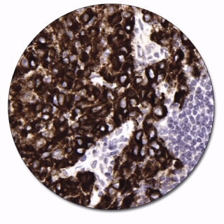 Melanosome (Concentrate)