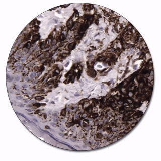 Melanosome (Concentrate)