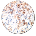 CD10 (Autostainer Link 48)