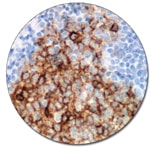 CD10 (Autostainer Link 48)