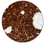 CD10 (Autostainer Link 48)