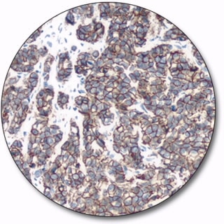 E- カドヘリン (濃縮抗体)