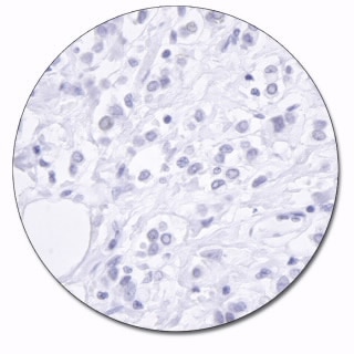 E- カドヘリン (濃縮抗体)