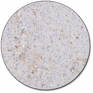 Alpha-1-Antitrypsin (Dako Omnis)