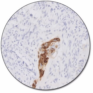 Alpha-1-Fetoprotein (Dako Omnis)