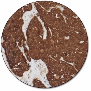 Calcitonin (Dako Omnis)