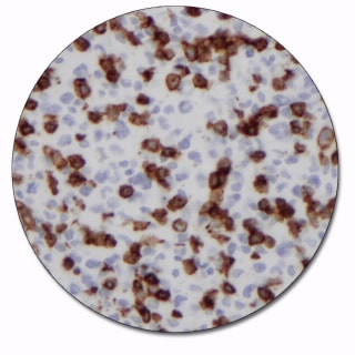 CD8 (Autostainer Link 48)