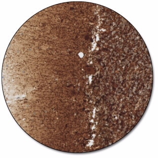 Neurofilament Protein (Dako Omnis)