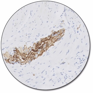 Neurofilament Protein (Dako Omnis)