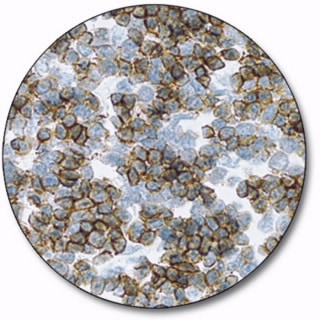 CD1a (Autostainer Link 48)