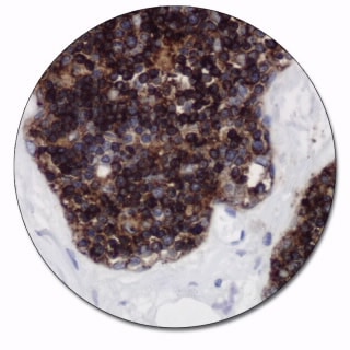 CD1a (Autostainer Link 48)