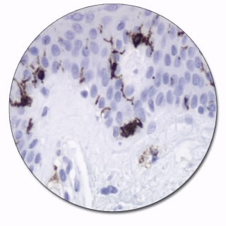 CD1a (Autostainer Link 48)