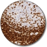 CD5 (Autostainer Link 48)