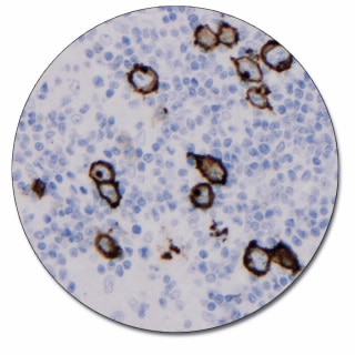 CD30 Antibody (Concentrate) Agilent