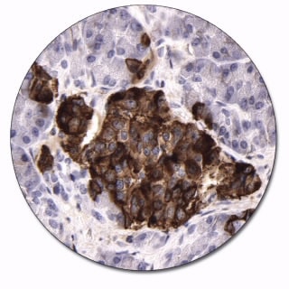 CD99、MIC2 遺伝子産物 (Ewing 肉腫マーカー) (ダコ　Autostainer Link 48 用)