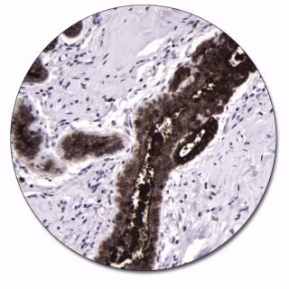 Epithelial Membrane Antigen (Concentrate)