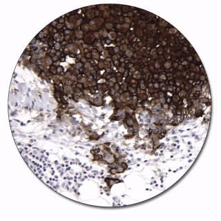 Epithelial Membrane Antigen (Autostainer Link 48)