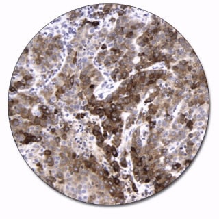 Epithelial Membrane Antigen (Autostainer Link 48)