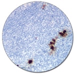 肥満細胞トリプターゼ (ダコ　Autostainer Link 48 用)