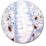 Mast Cell Tryptase (Autostainer Link 48)