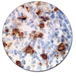 Mast Cell Tryptase (Autostainer Link 48)