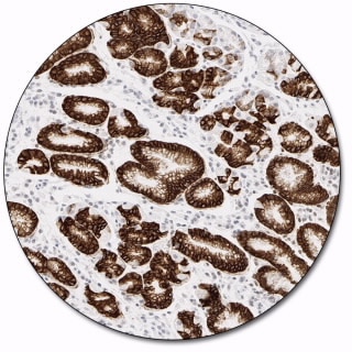 MUC5AC (Autostainer Link 48)