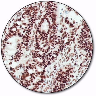 MutS Protein Homolog 2 (Autostainer Link 48)