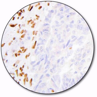 MutS Protein Homolog 2 (Autostainer Link 48)
