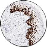 p63 Protein (Autostainer Link 48)